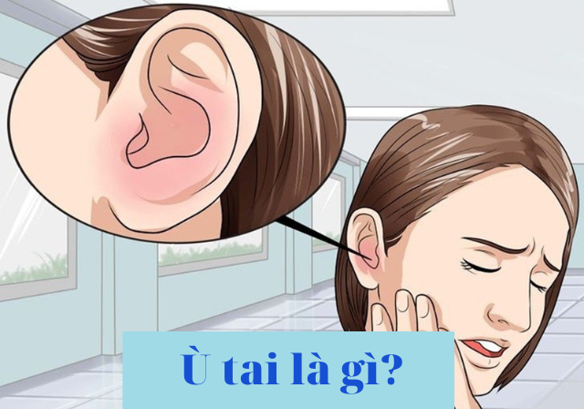 Ù tai là bệnh gì?